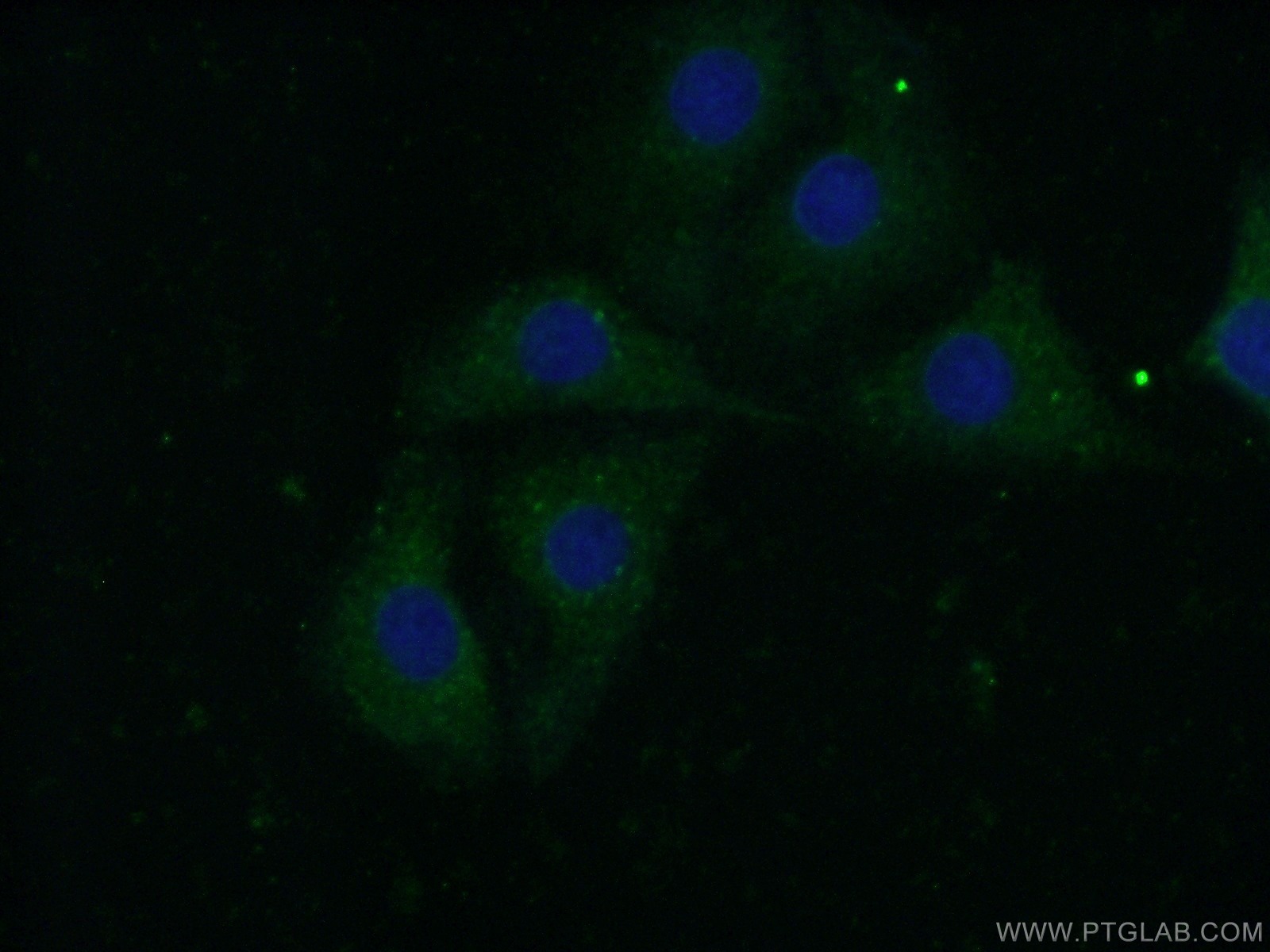 IF Staining of SH-SY5Y using 11490-2-AP