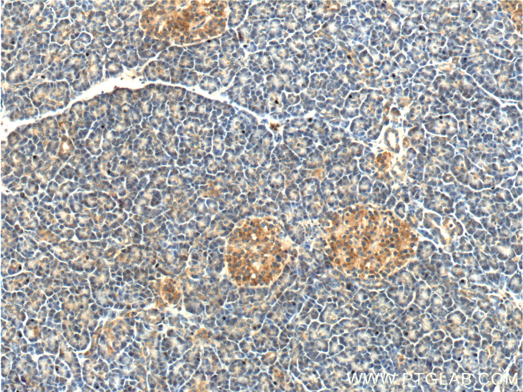 IHC staining of human pancreas using 11490-2-AP