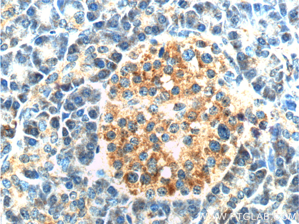 IHC staining of human pancreas using 11490-2-AP