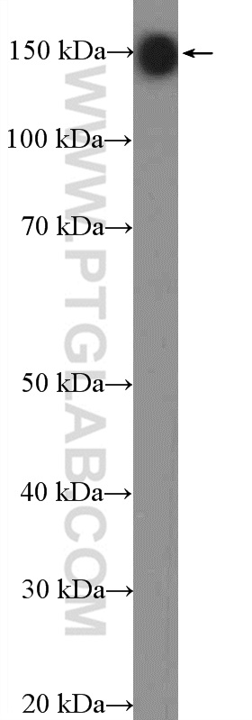 WB analysis of rat brain using 11490-2-AP