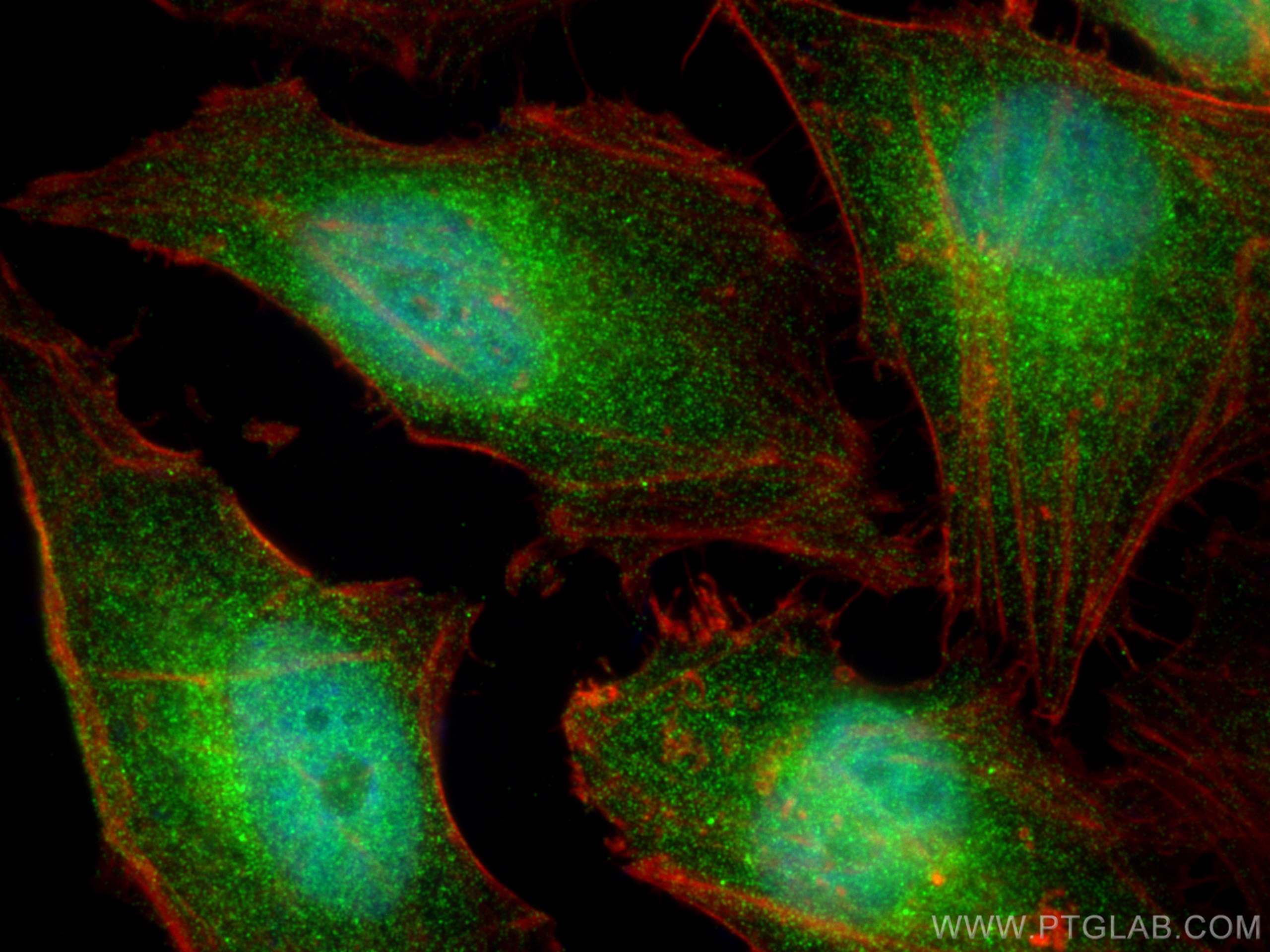 IF Staining of HeLa using 19843-1-AP