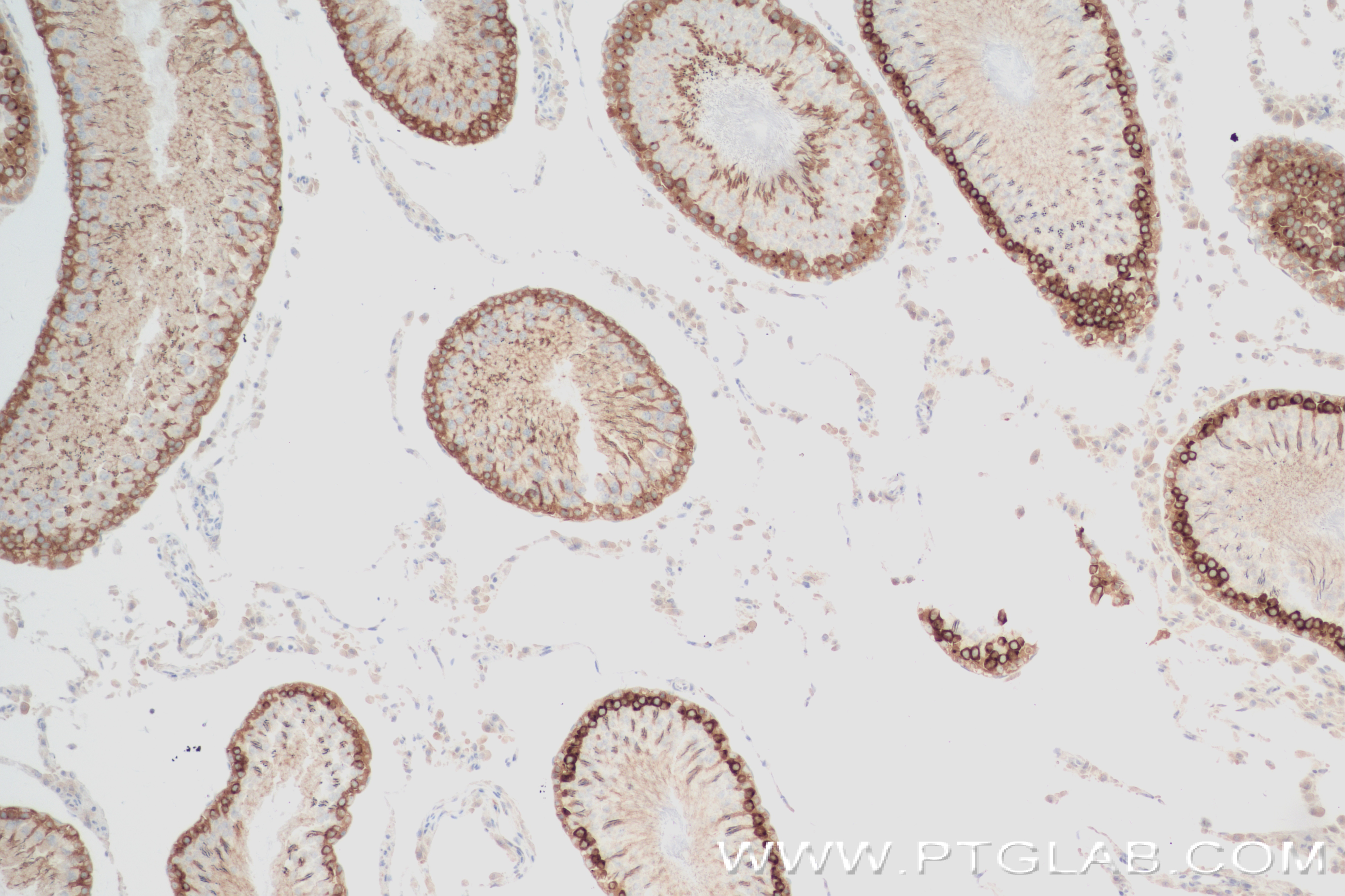 IHC staining of rat testis using 84009-4-RR