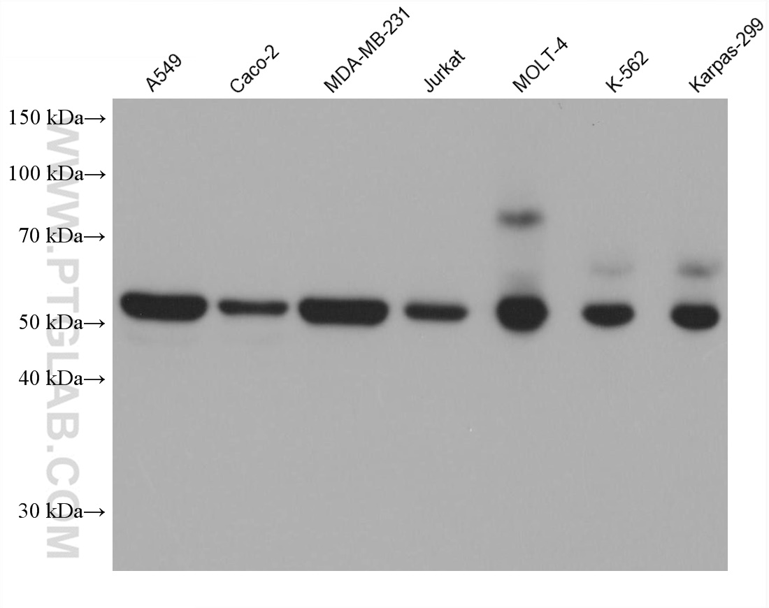 WB analysis using 66401-1-Ig