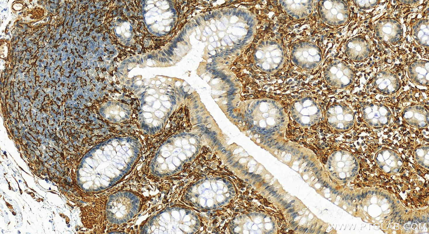 IHC staining of human colon using 20887-1-AP