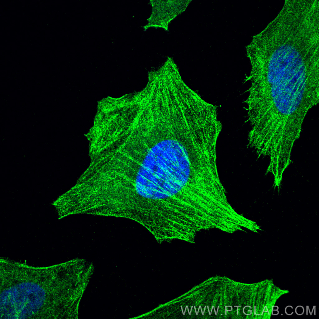 IF Staining of HeLa using 20887-1-AP