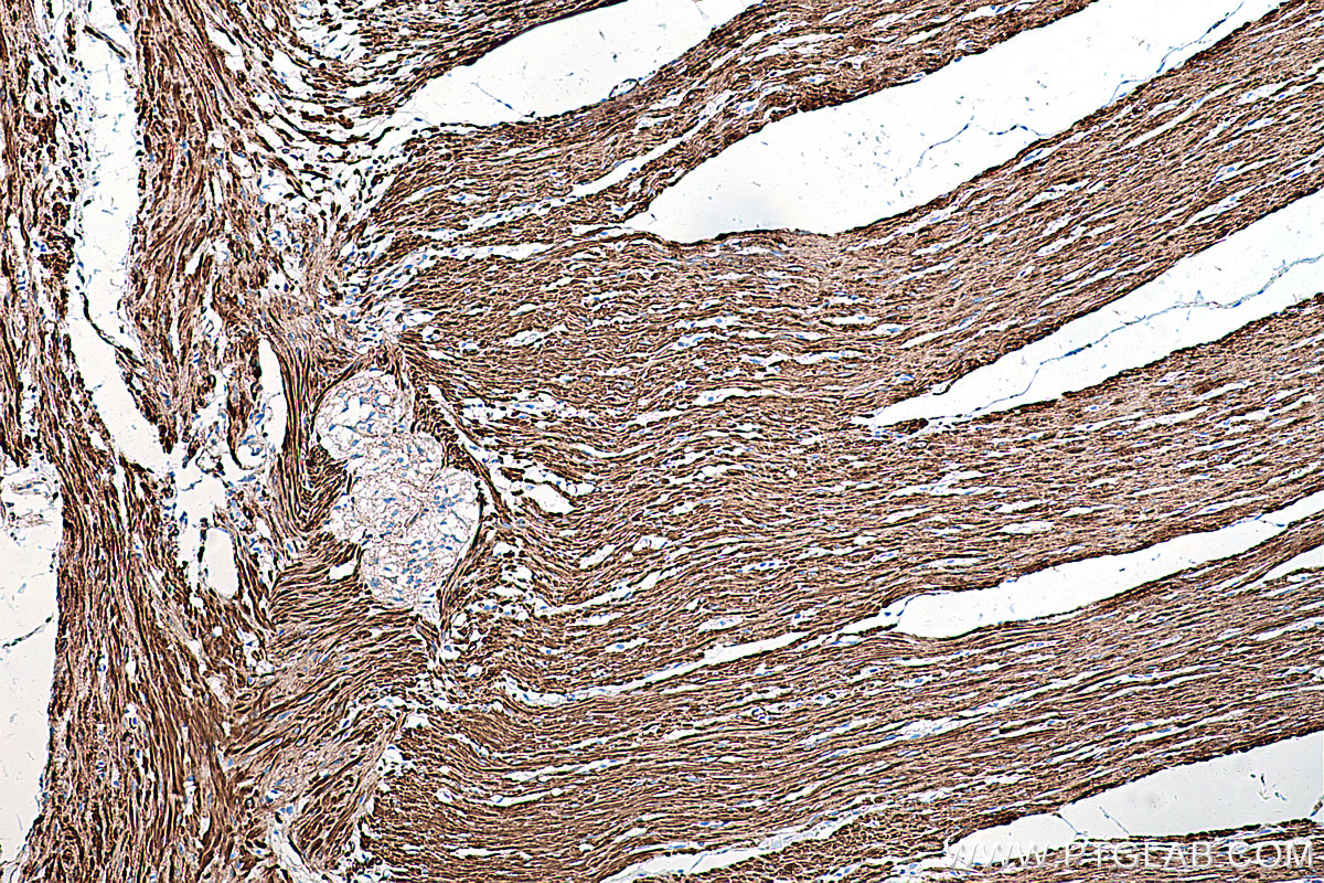 IHC staining of human colon using 66693-1-Ig