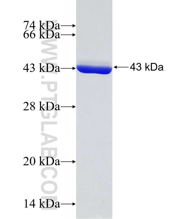 CALM3 fusion protein Ag31782 SDS-PAGE