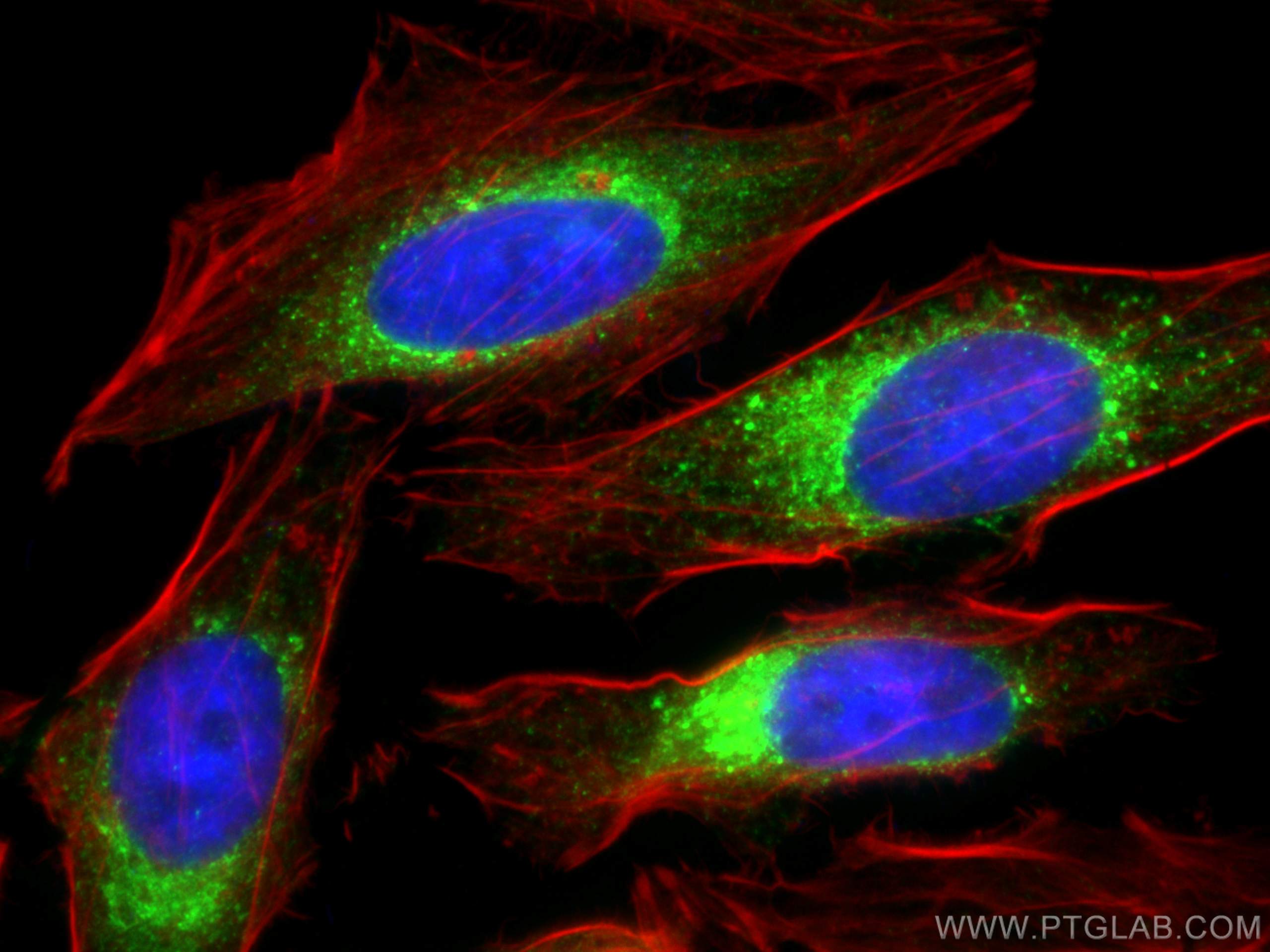 IF Staining of HeLa using 17804-1-AP