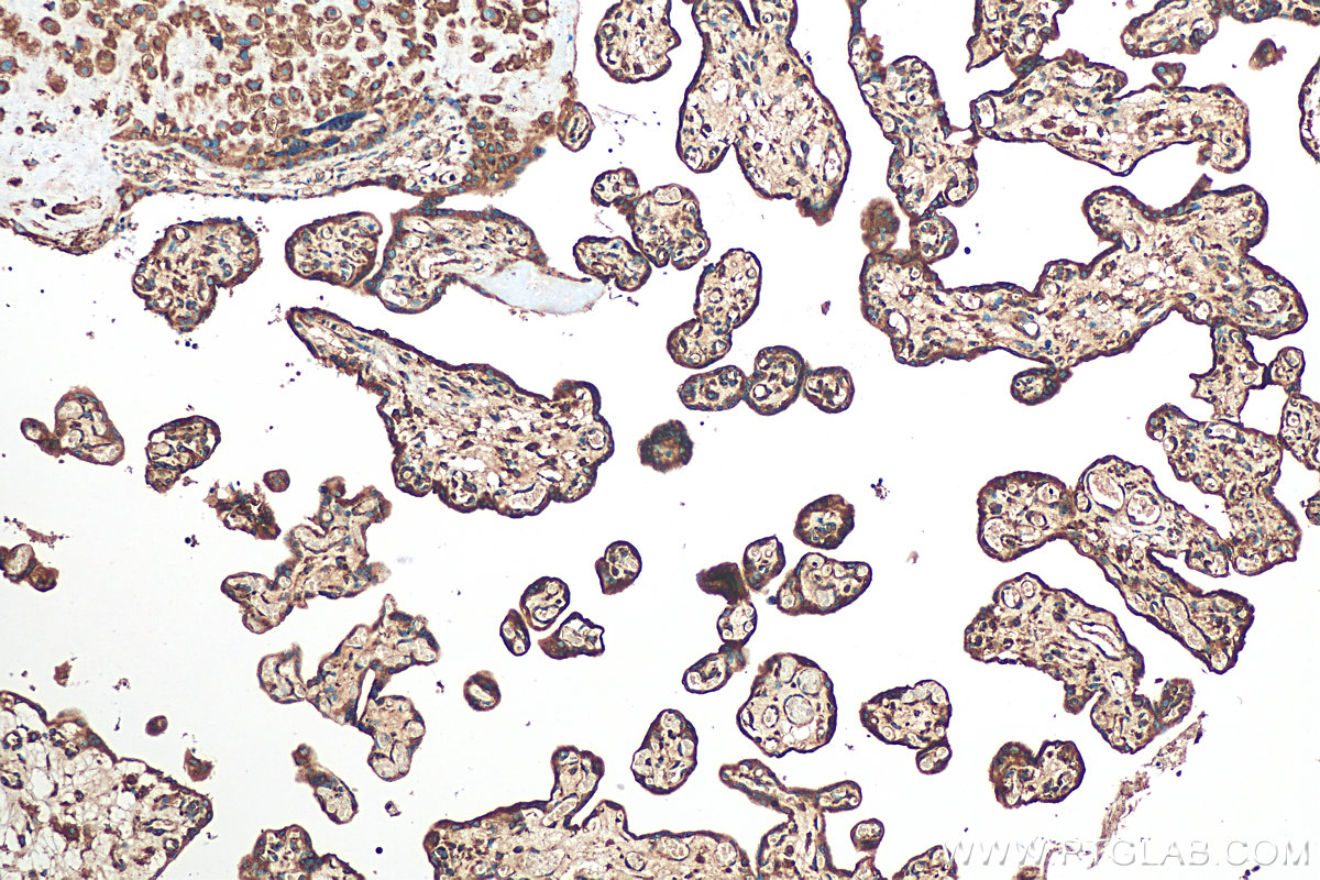 IHC staining of human placenta using 17804-1-AP