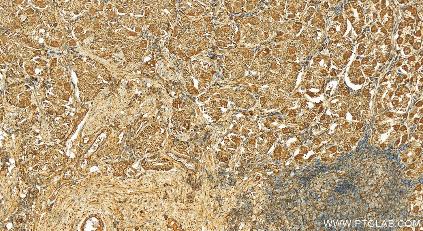 IHC staining of human stomach using 13624-1-AP