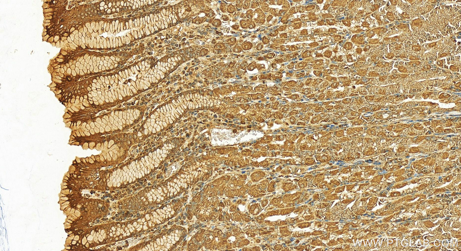 IHC staining of human stomach using 13624-1-AP