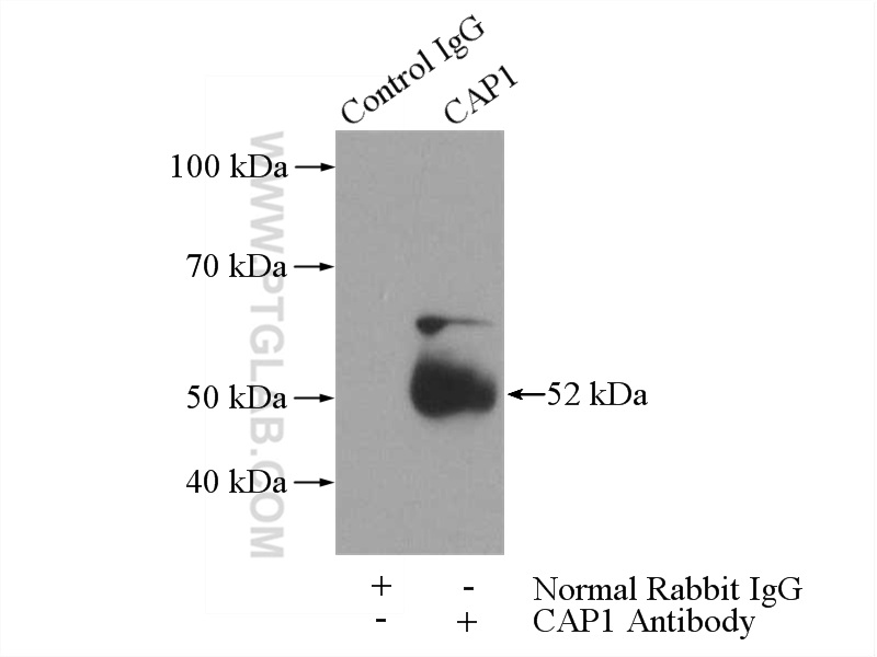 IP experiment of A431 using 16231-1-AP