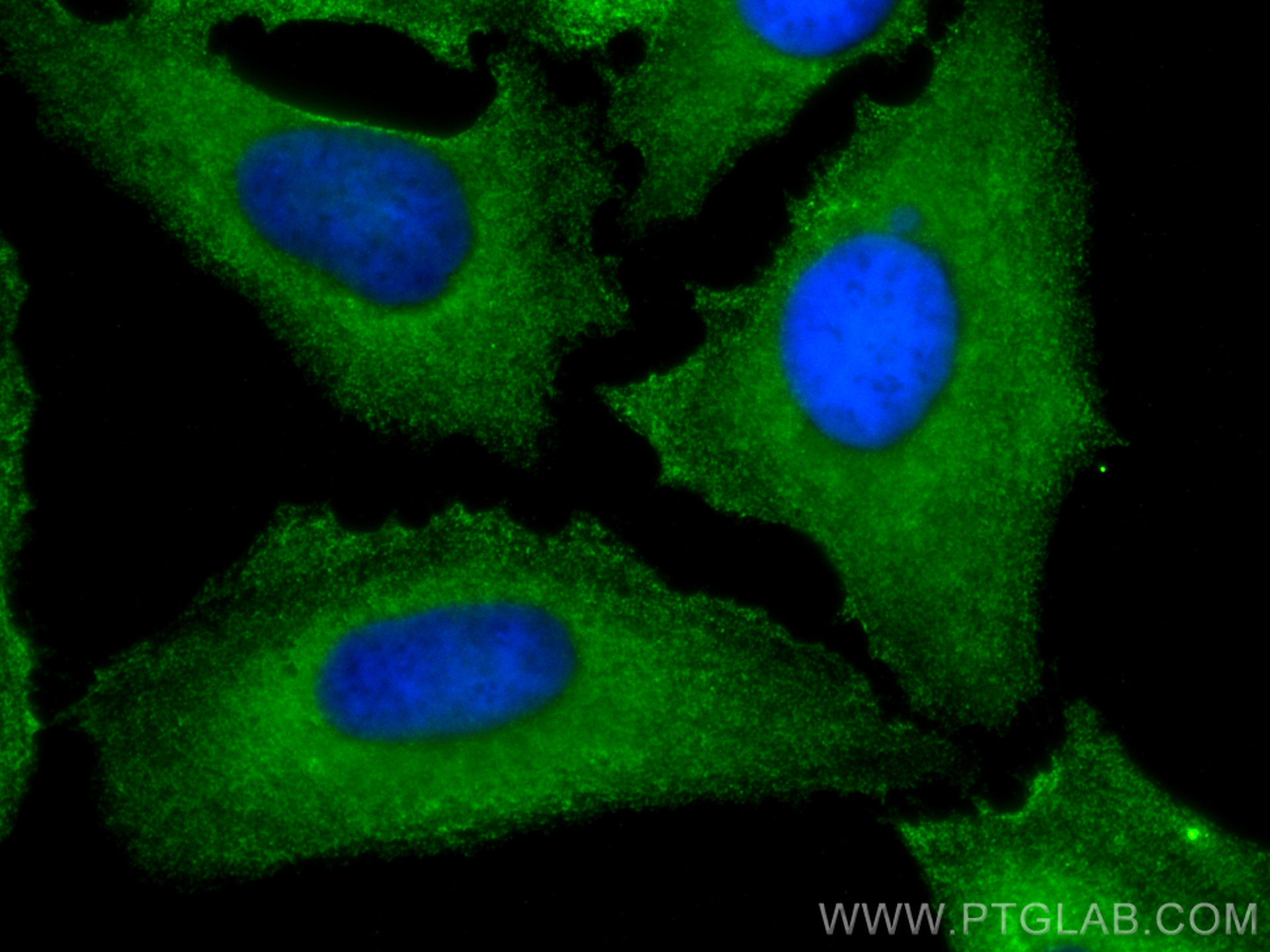 IF Staining of HeLa using 68207-1-Ig (same clone as 68207-1-PBS)