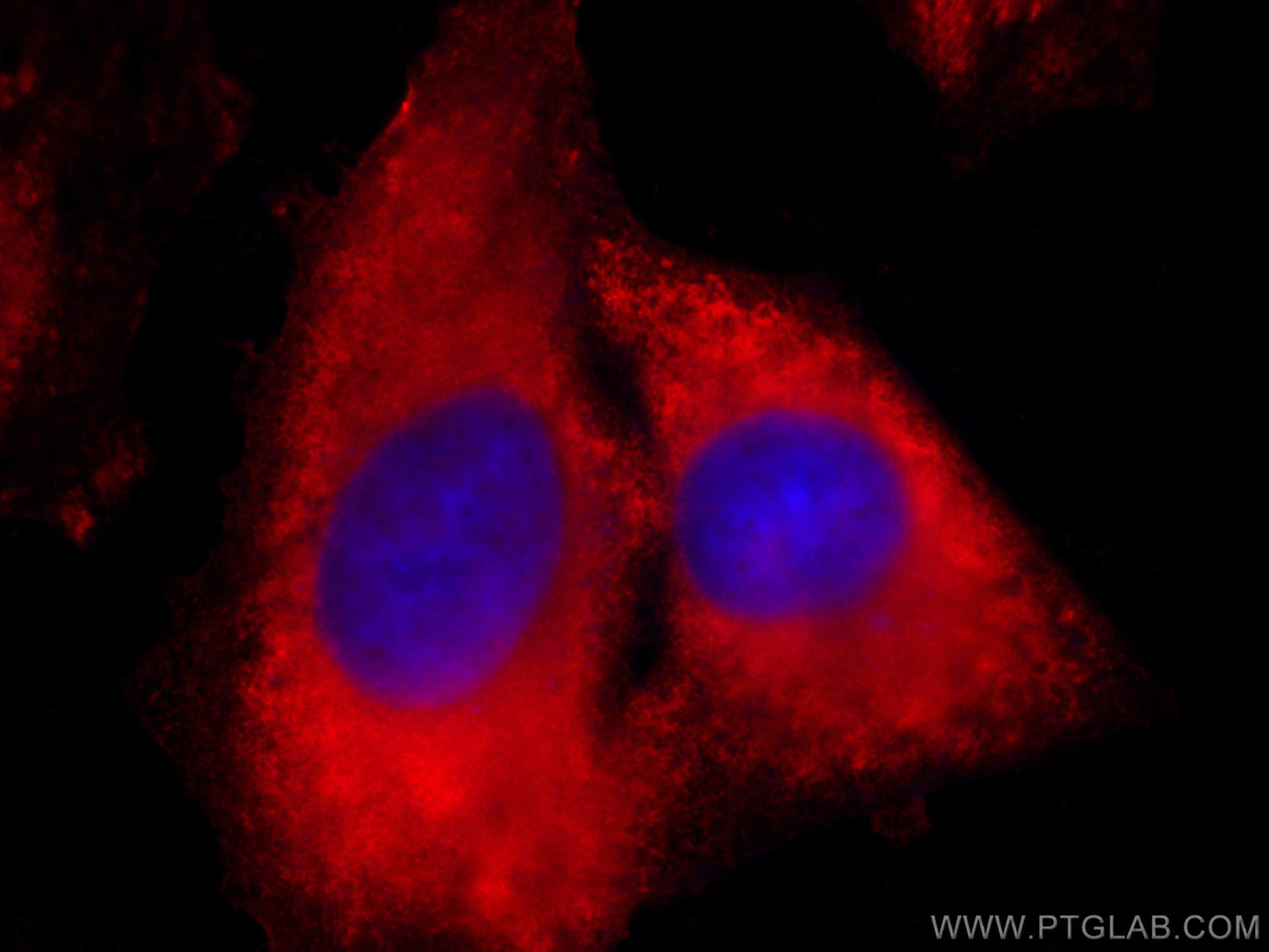 IF Staining of HeLa using CL594-66277