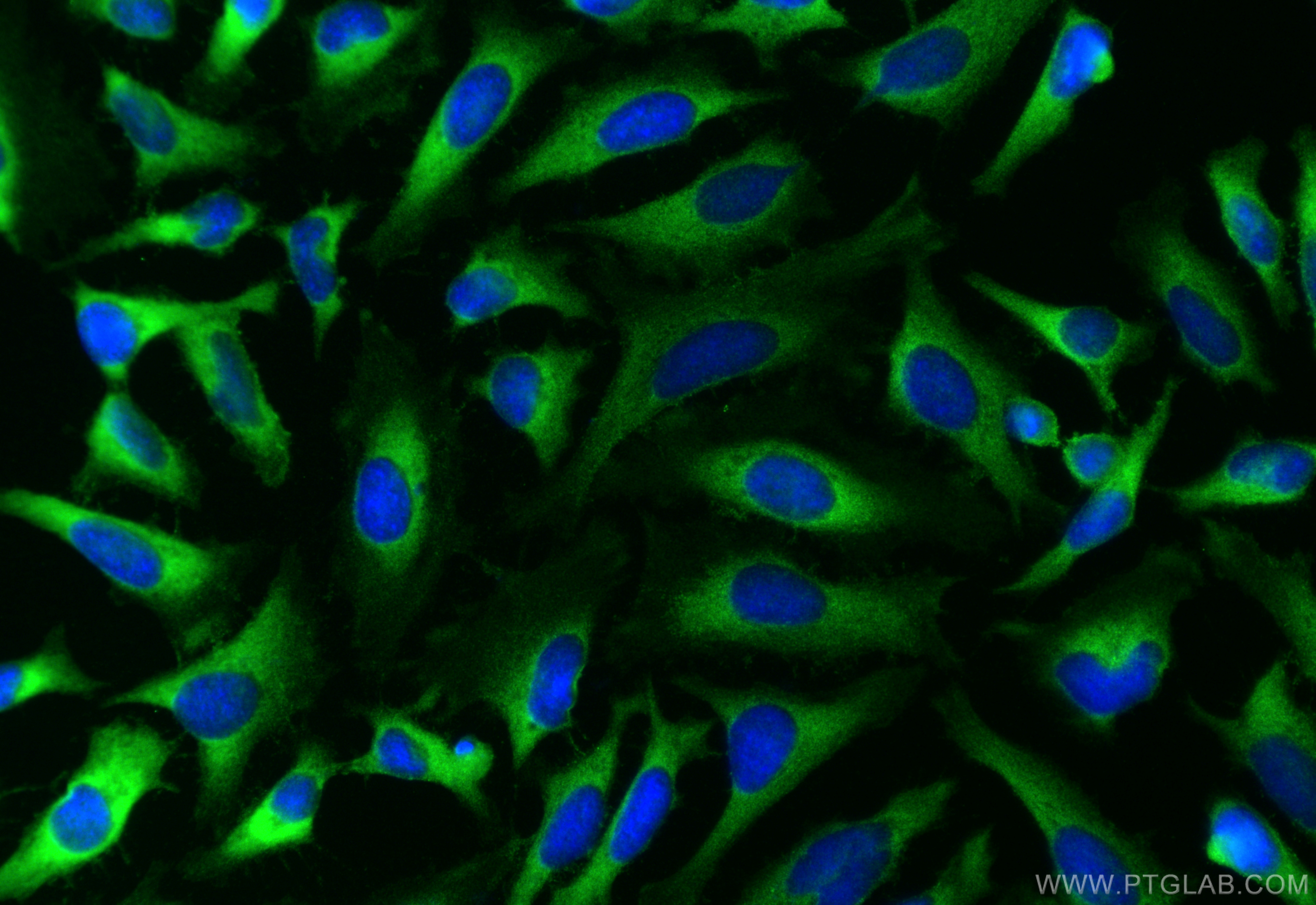 IF Staining of HeLa using 10538-1-AP