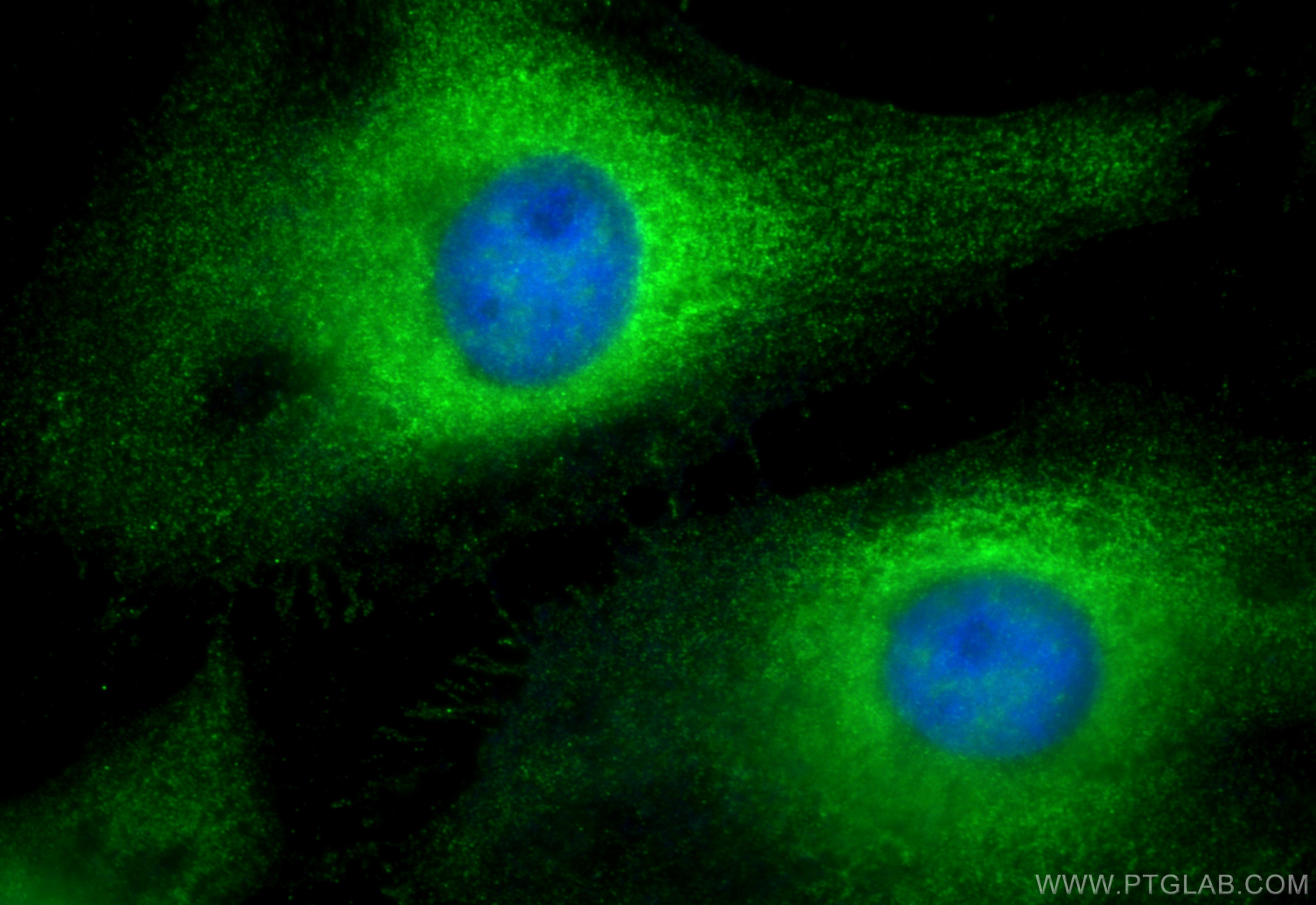 IF Staining of HeLa using 13675-1-AP