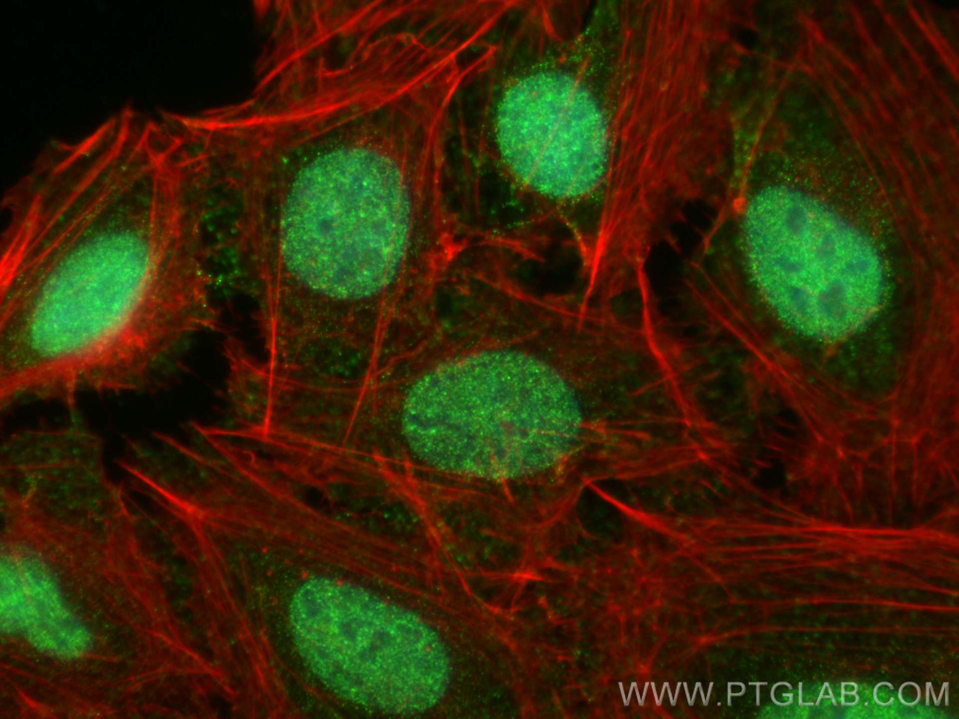 IF Staining of U2OS using 67366-1-Ig (same clone as 67366-1-PBS)