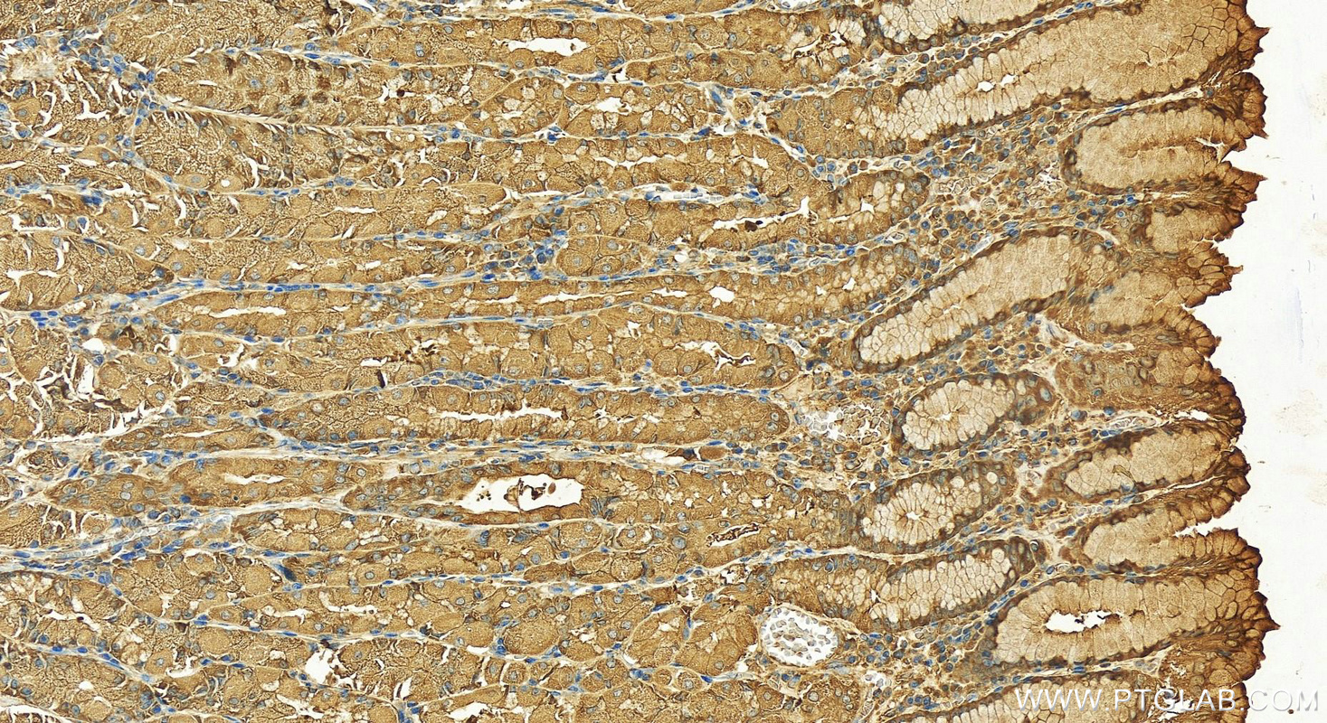 IHC staining of human stomach using 25057-1-AP