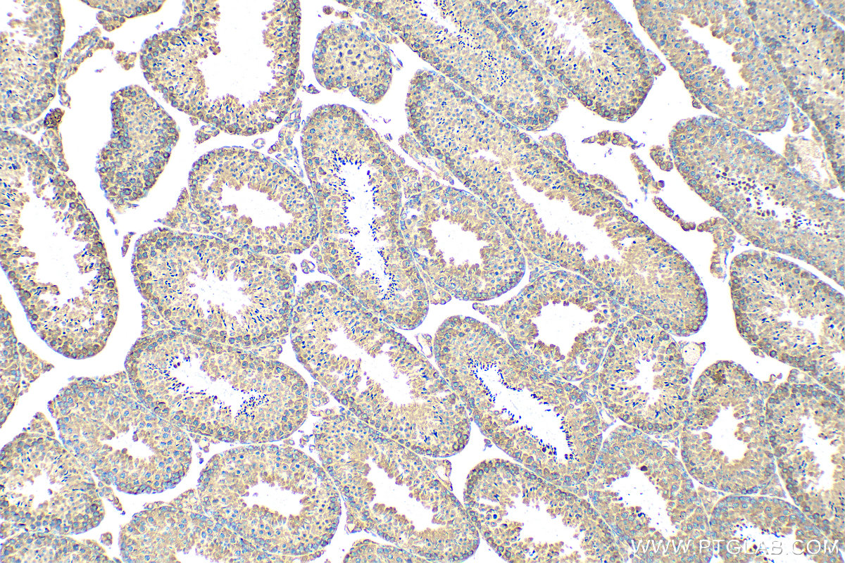 IHC staining of mouse testis using 15112-1-AP