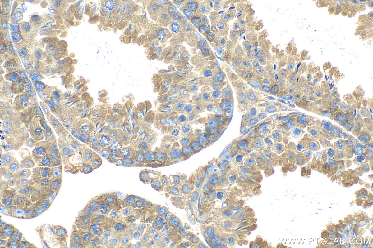 IHC staining of mouse testis using 15112-1-AP