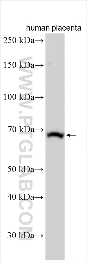 WB analysis using 11924-1-AP