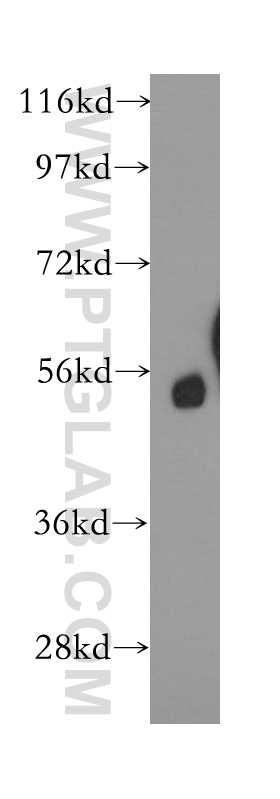 Calcyphosine 2