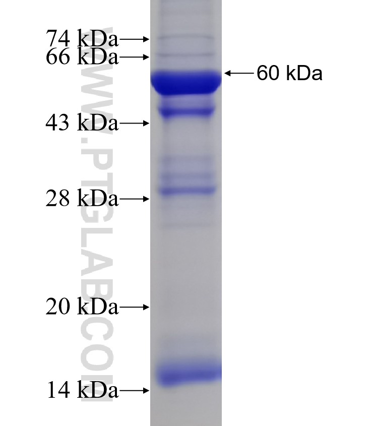 CAPS2 fusion protein Ag2571 SDS-PAGE