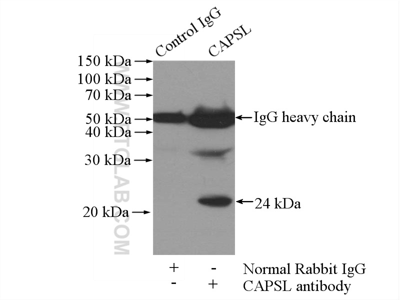 IP experiment of mouse lung using 17174-1-AP