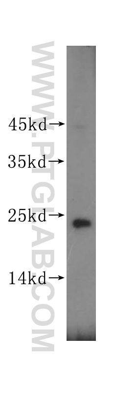 WB analysis of mouse lung using 17174-1-AP