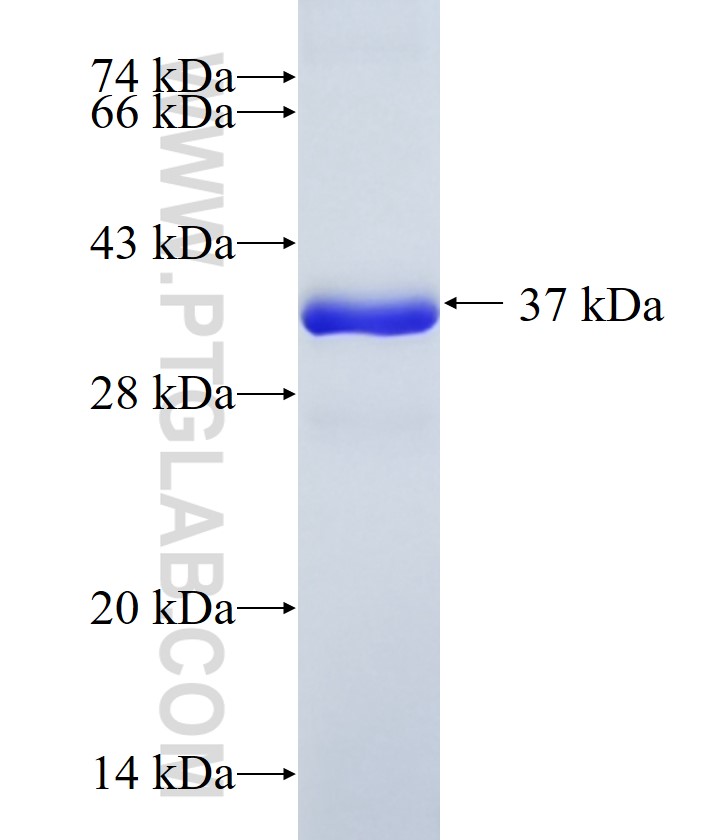 CAPZA2 fusion protein Ag8650 SDS-PAGE