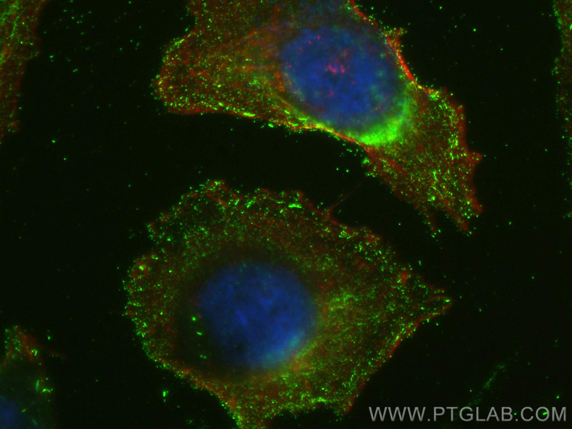 IF Staining of HeLa using 68657-1-Ig