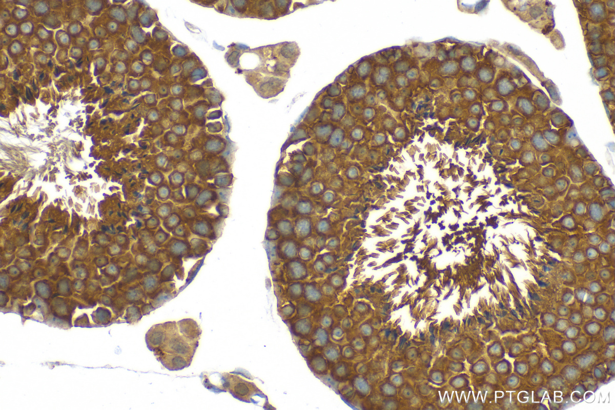 IHC staining of mouse testis using 83300-2-RR