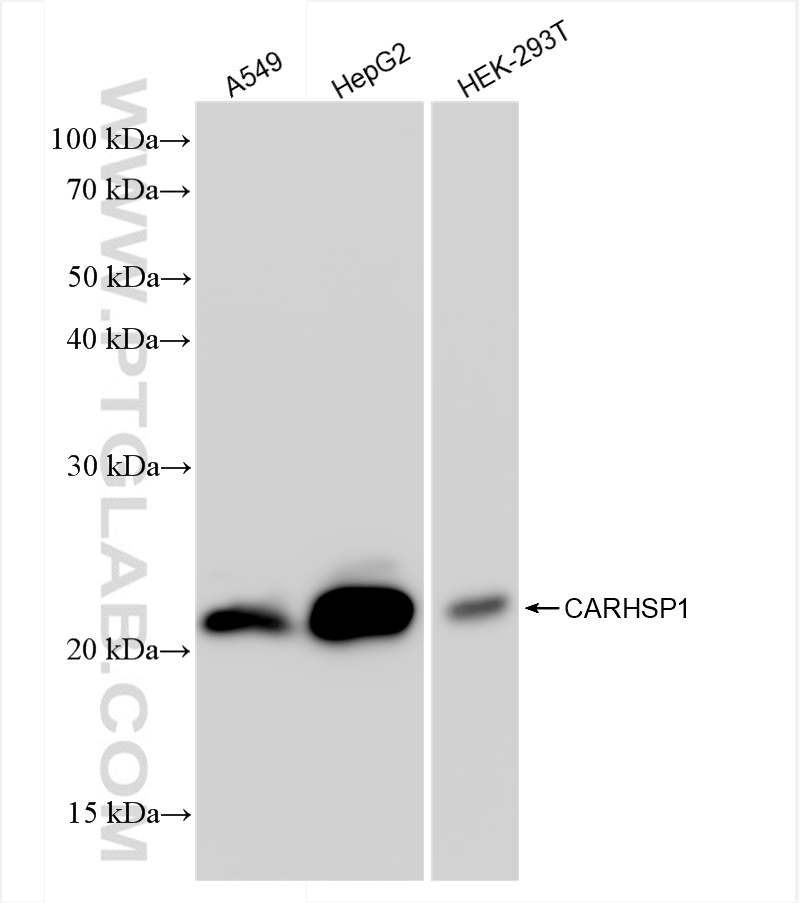 WB analysis using 83300-3-RR (same clone as 83300-3-PBS)