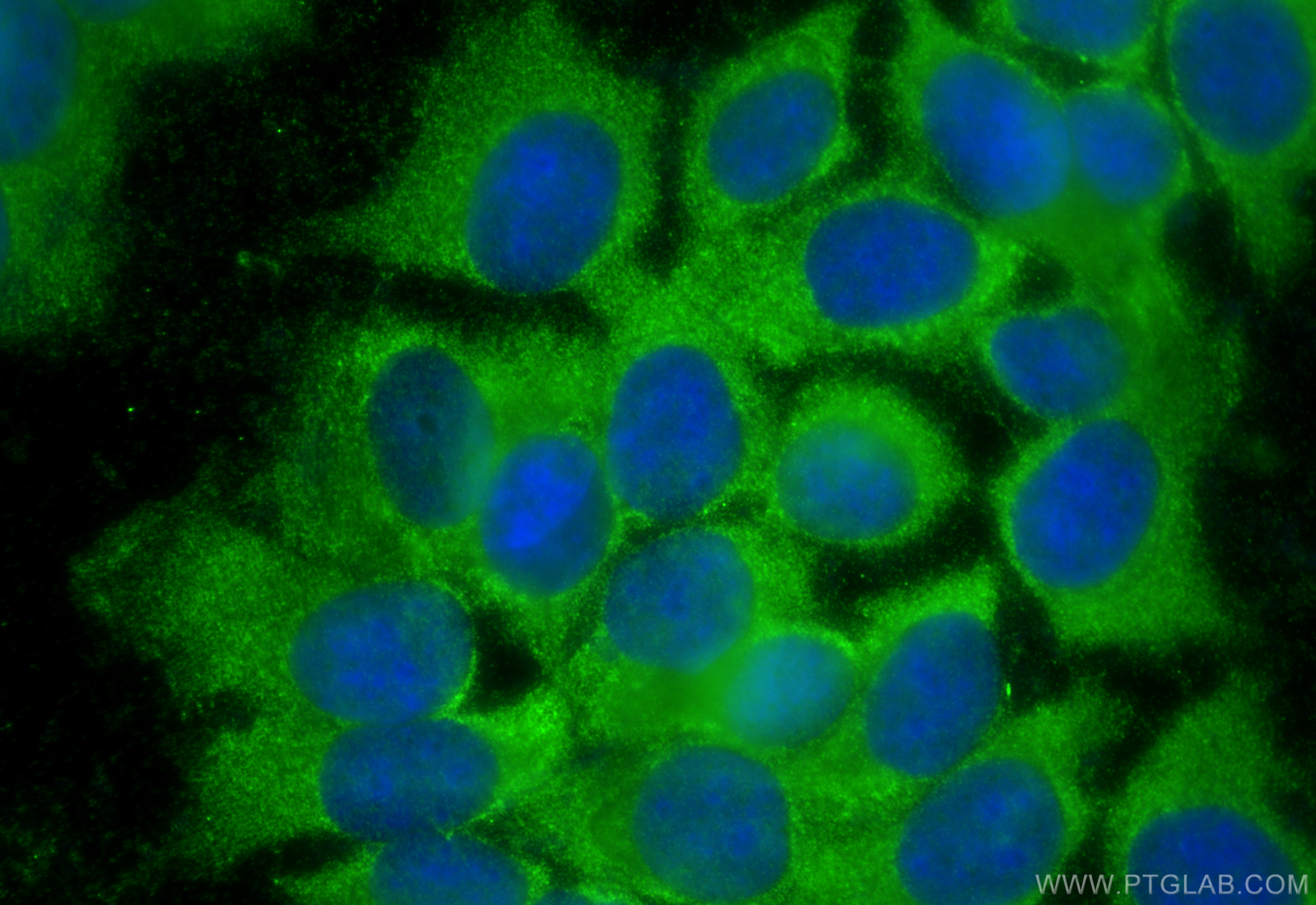 IF Staining of MCF-7 using 15296-1-AP