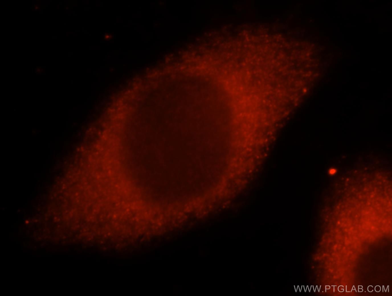 IF Staining of MCF-7 using 15296-1-AP