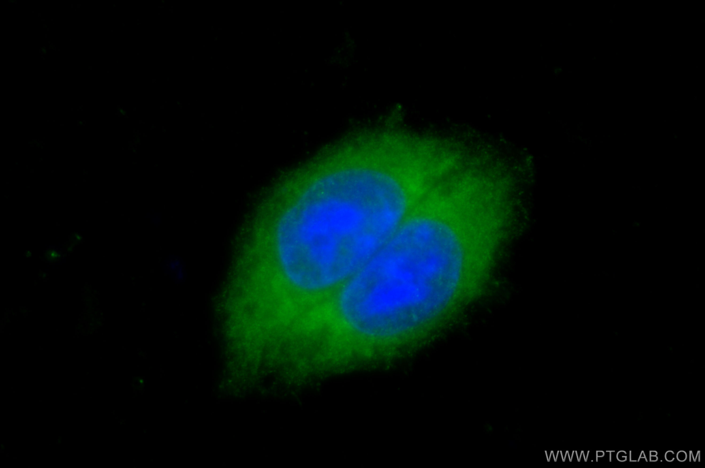 IF Staining of HepG2 using 11856-1-AP