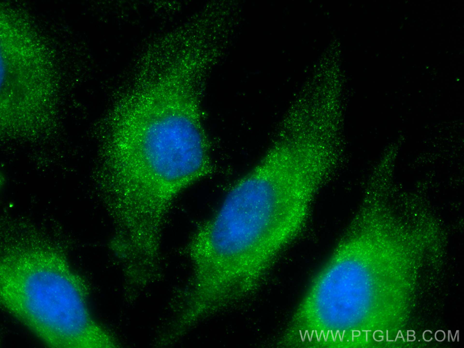 IF Staining of HeLa using 66093-1-Ig