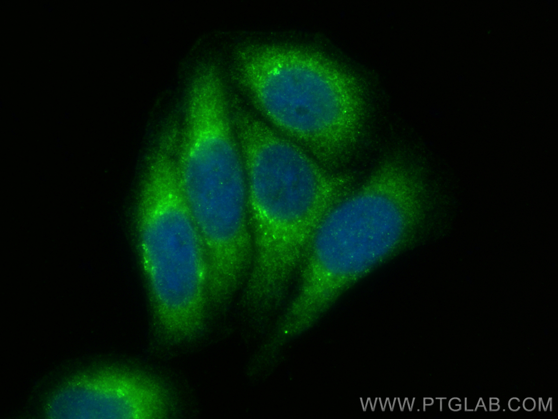 IF Staining of HepG2 using 10380-1-AP