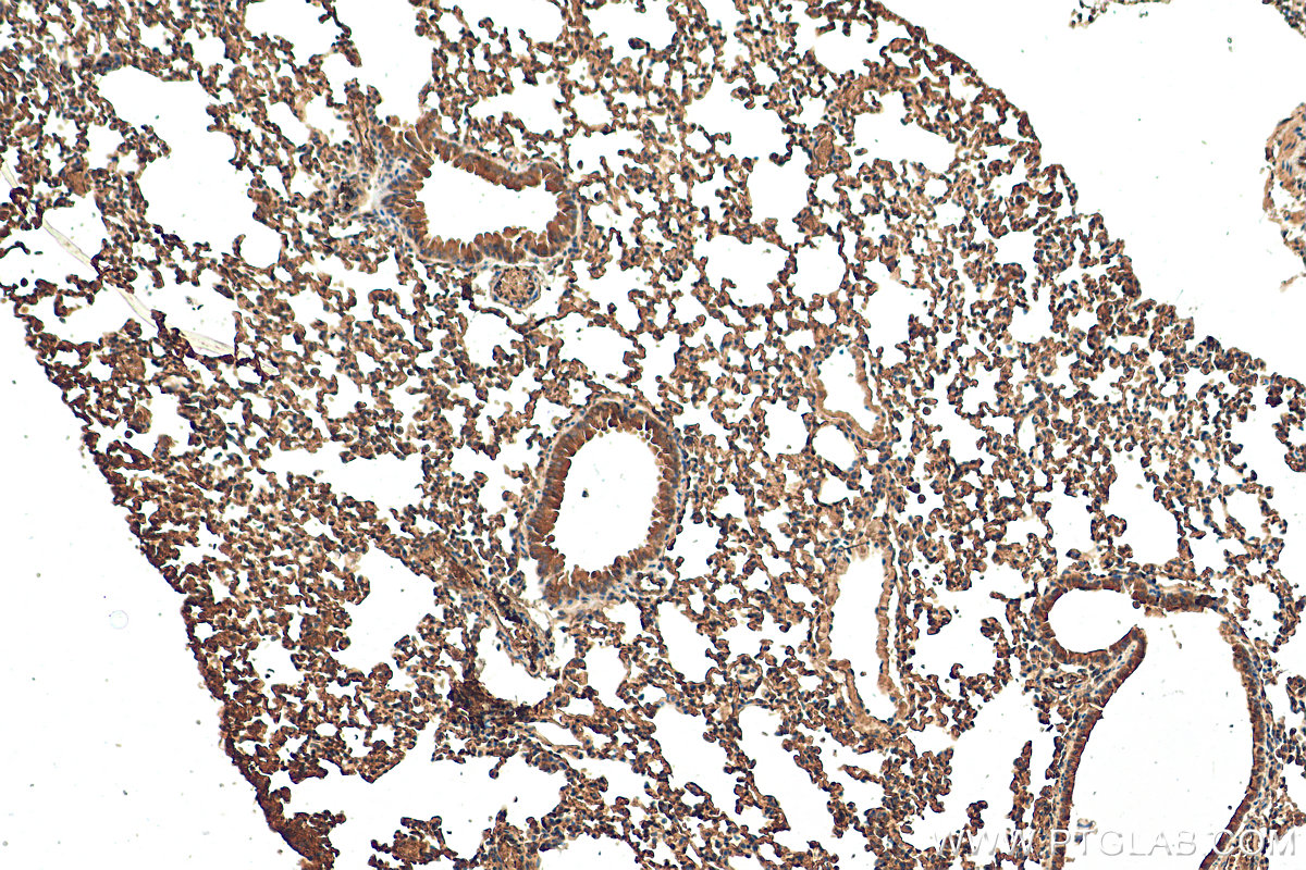 IHC staining of mouse lung using 10380-1-AP