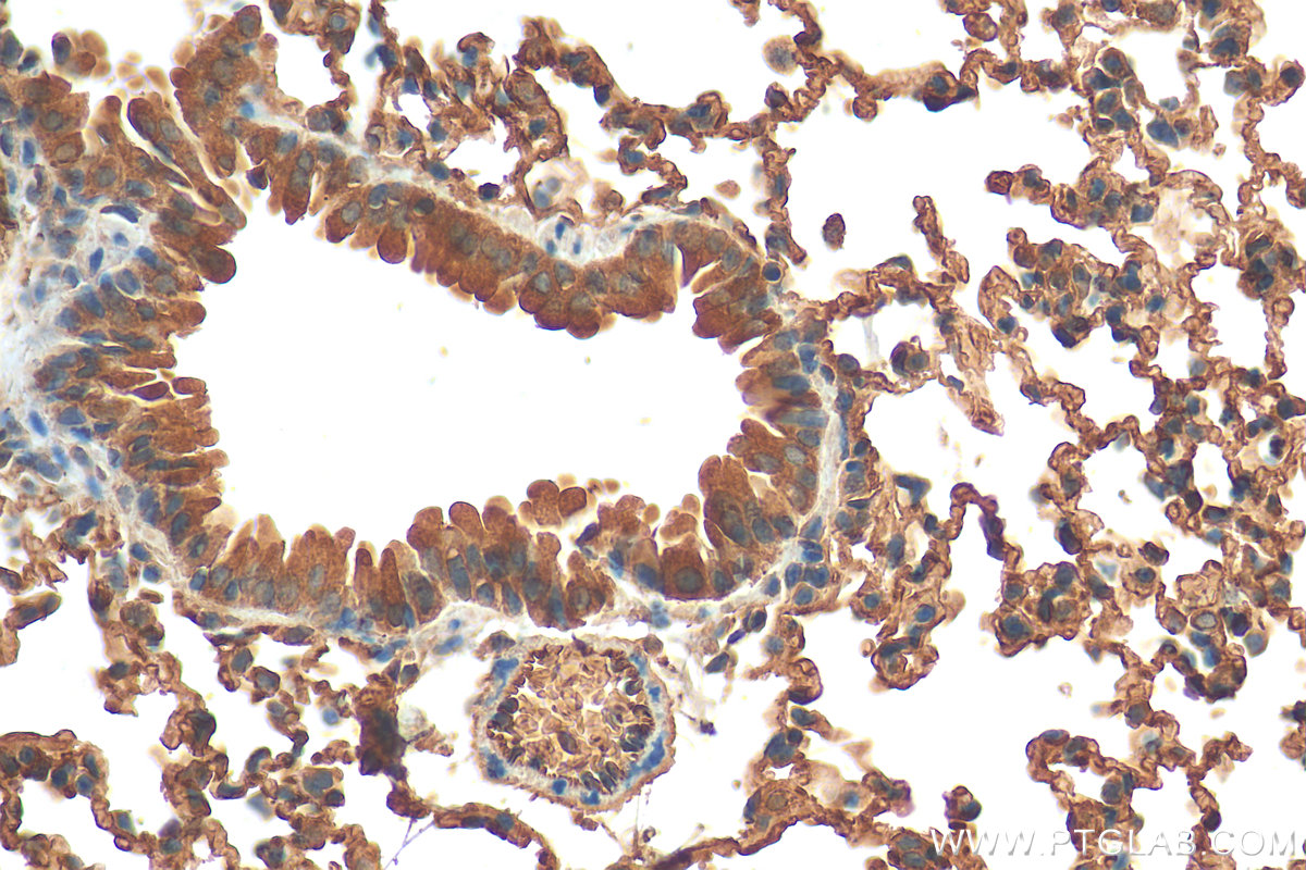 IHC staining of mouse lung using 10380-1-AP