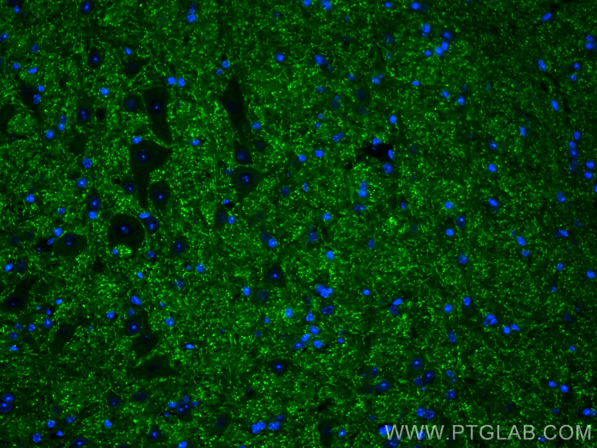 IF Staining of mouse cerebellum using 55417-1-AP