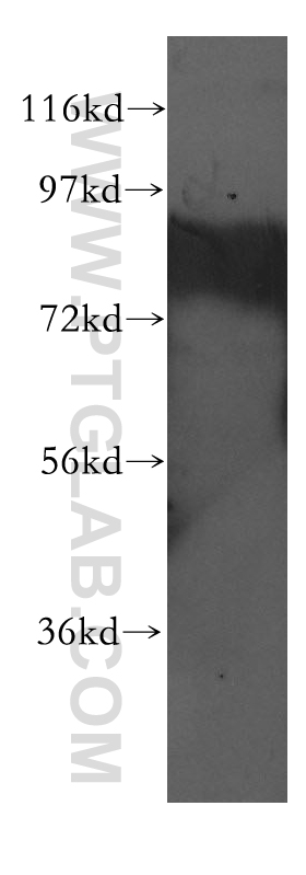 WB analysis of HEK-293 using 11336-1-AP