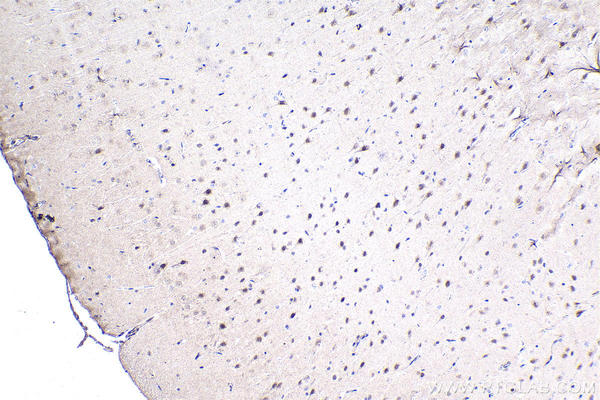 IHC staining of rat brain using 17190-1-AP