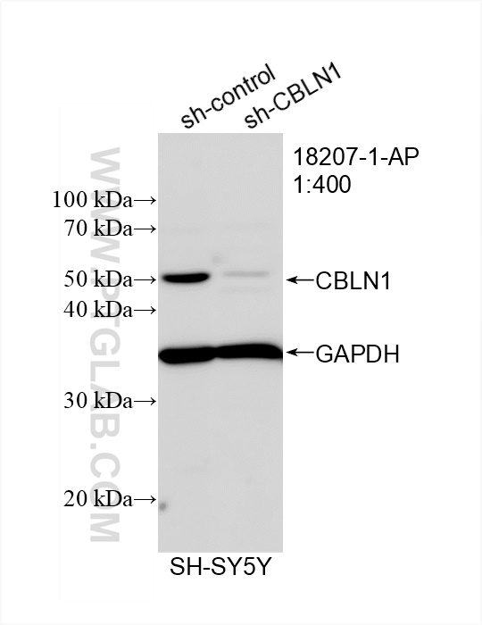 WB analysis of SH-SY5Y using 18207-1-AP