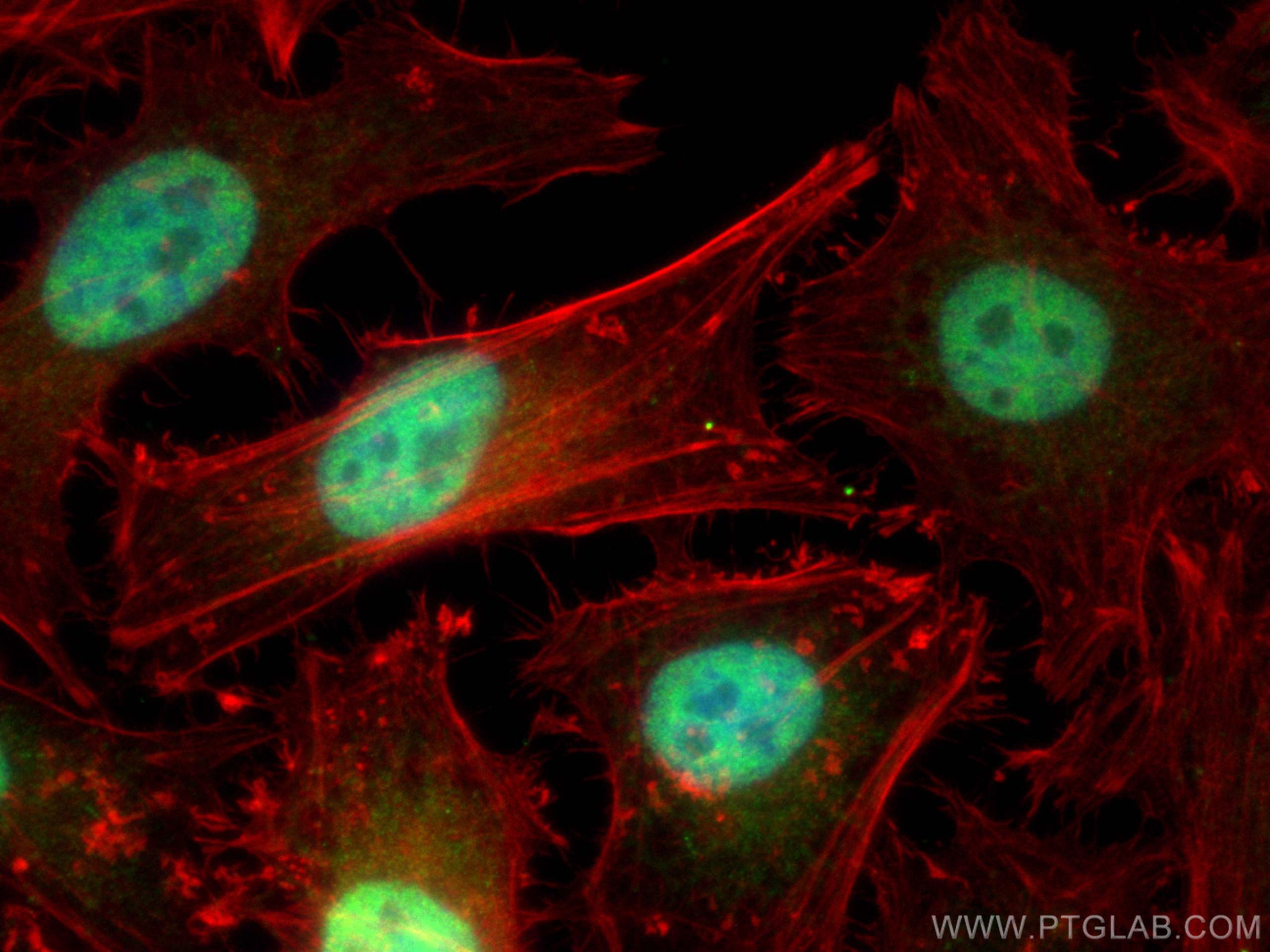 IF Staining of HeLa using 11950-1-AP