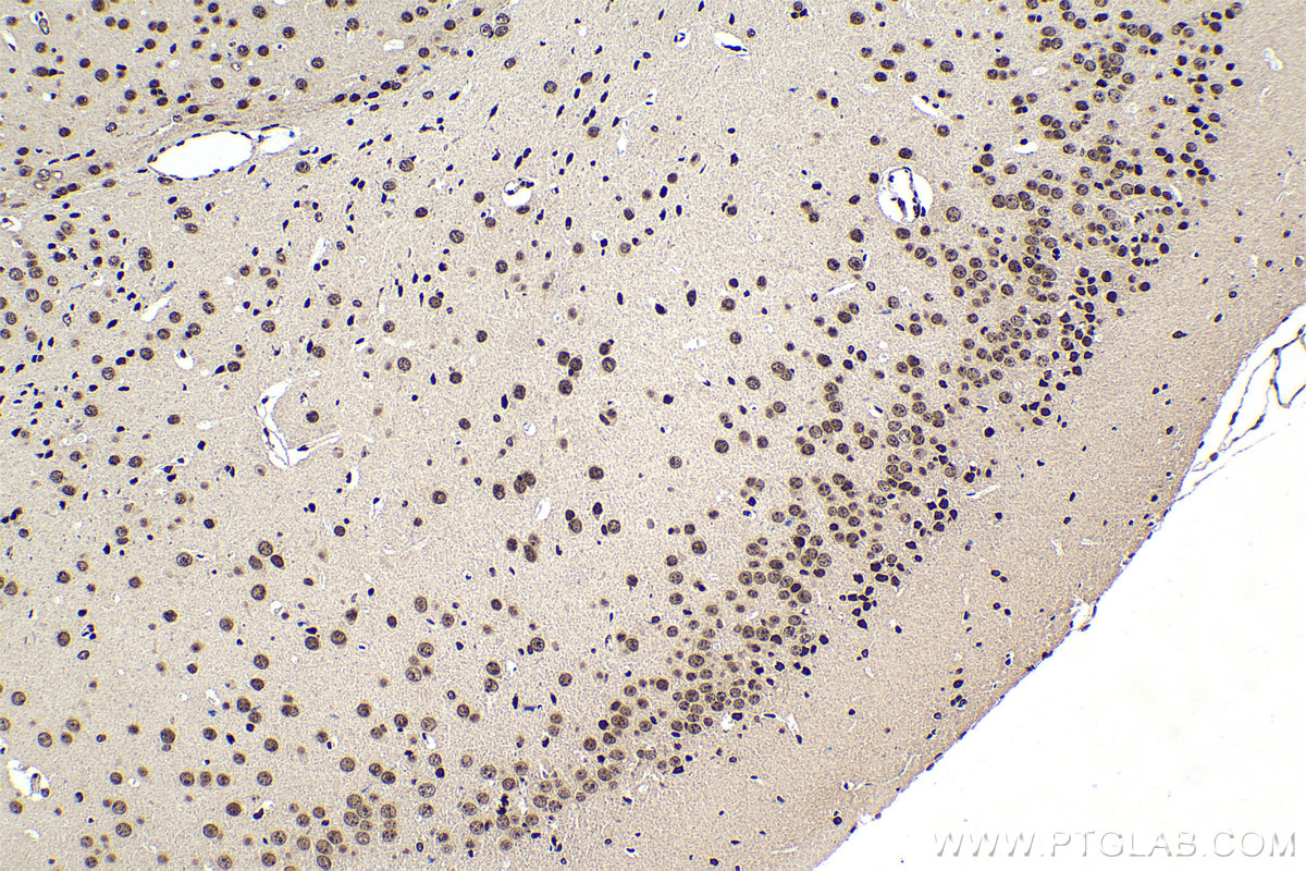 IHC staining of mouse brain using 11950-1-AP