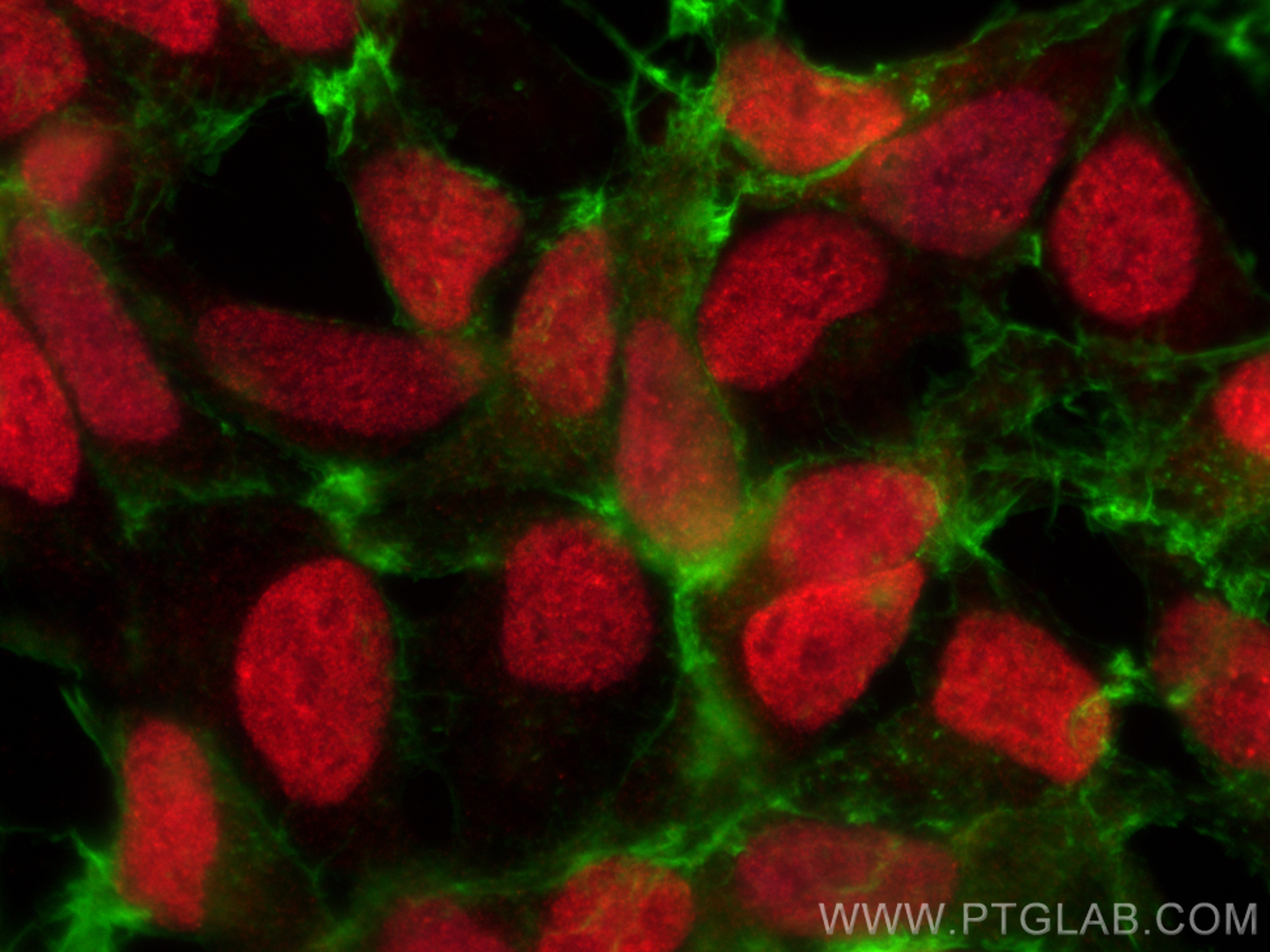 IF Staining of HEK-293 using 10241-2-AP