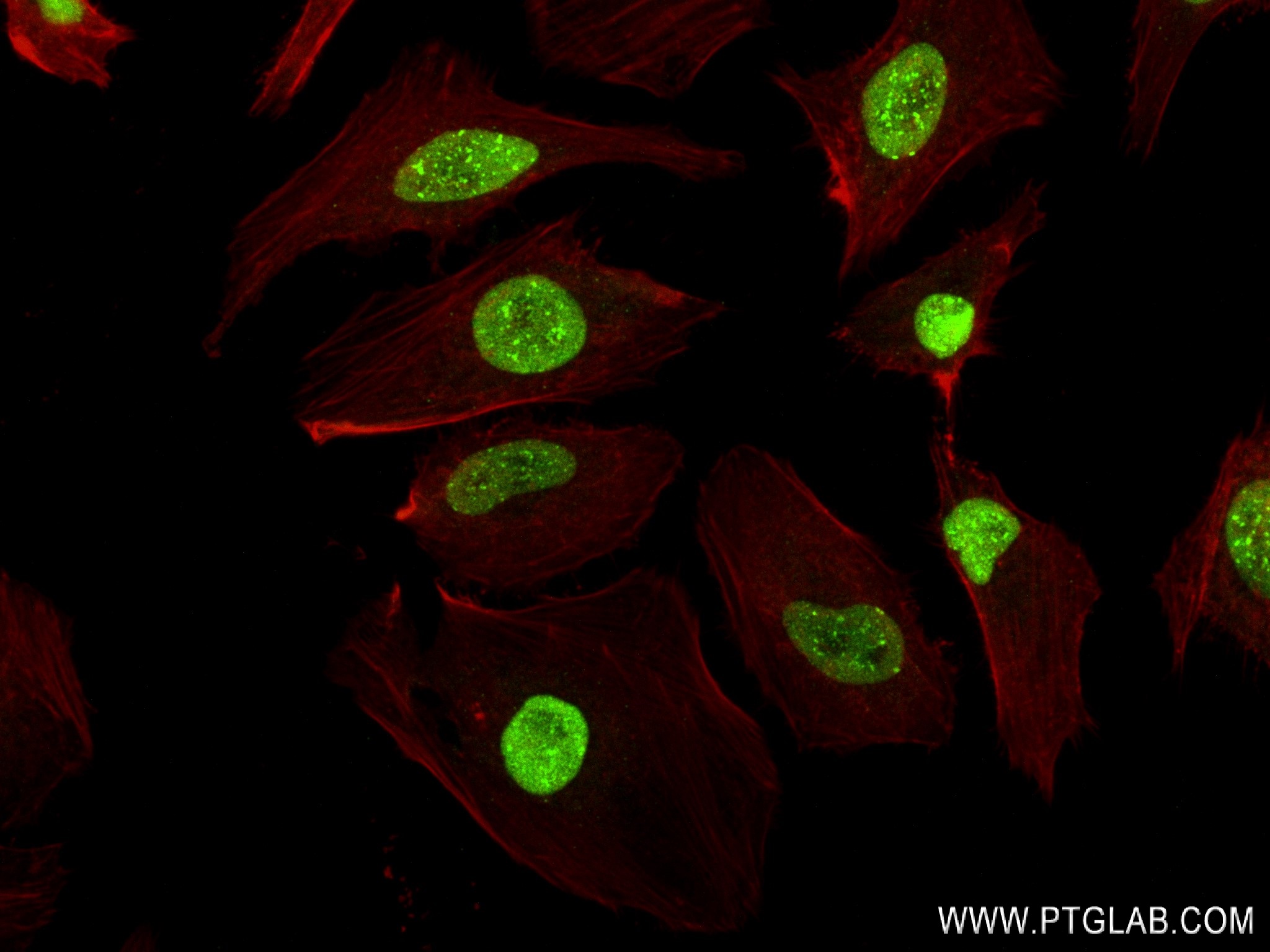 IF Staining of HeLa using 83248-4-RR (same clone as 83248-4-PBS)