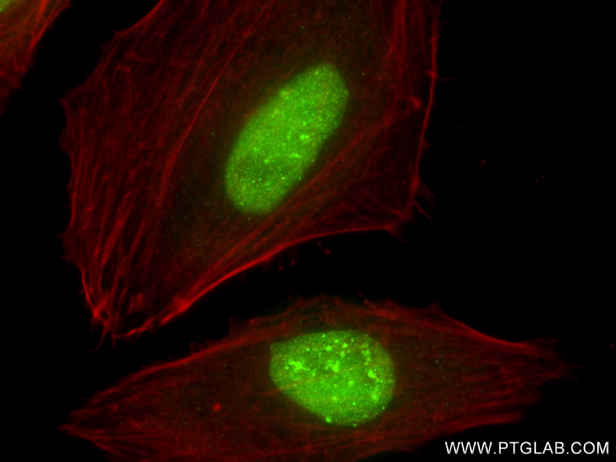 IF Staining of HeLa using 83248-4-RR (same clone as 83248-4-PBS)