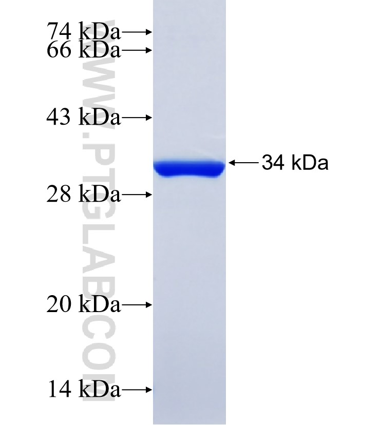 CBX1 fusion protein Ag34901 SDS-PAGE